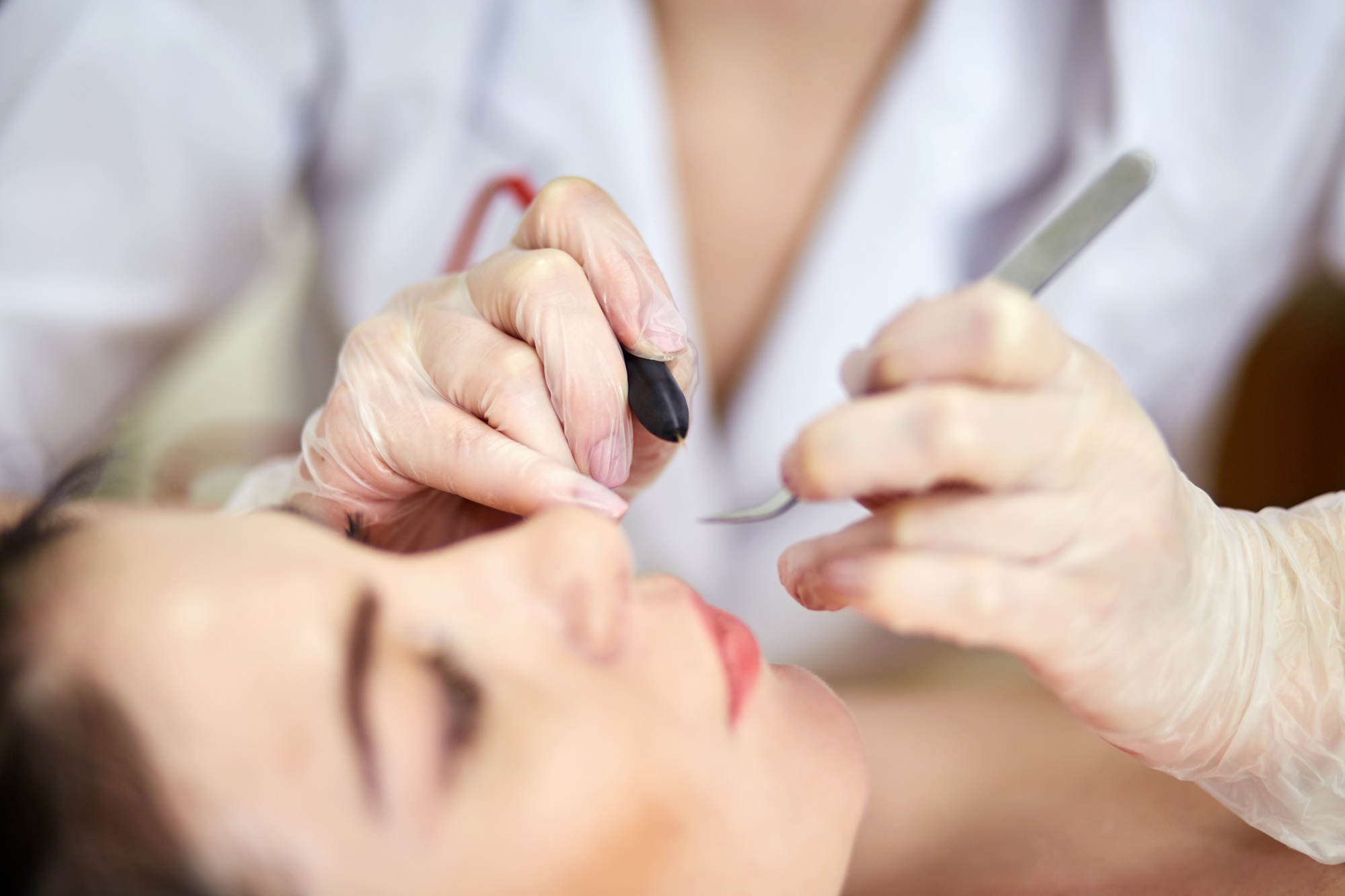 美容施術の様子